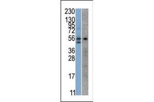 The anti-STK38 Pab (ABIN391097 and ABIN2841236) is used in Western blot to detect STK38 in SK-Br-3 (left) and Jurkat (right) cell line lysates. (STK38 抗体  (C-Term))