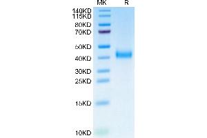SDS-PAGE (SDS) image for Interleukin 2 Receptor, beta (IL2RB) (AA 27-239) protein (His tag,Biotin) (ABIN7274057)