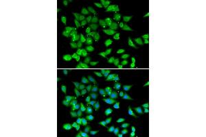 Immunofluorescence analysis of HeLa cells using NFATC3 antibody. (NFATC3 抗体)