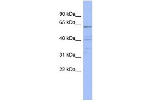 WB Suggested Anti-ZNF689 Antibody Titration:  0. (ZNF689 抗体  (N-Term))