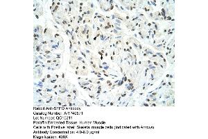 Rabbit Anti-SFPQ Antibody  Paraffin Embedded Tissue: Human Muscle Cellular Data: Skeletal muscle cells Antibody Concentration: 4. (SFPQ 抗体  (Middle Region))