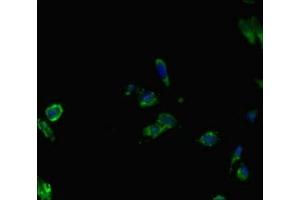 Immunofluorescent analysis of Hela cells using ABIN7145087 at dilution of 1:100 and Alexa Fluor 488-congugated AffiniPure Goat Anti-Rabbit IgG(H+L) (AIRE 抗体  (AA 39-108))
