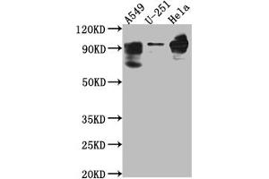 Western Blot Positive WB detected in: THP-1 whole cell lysate All lanes: PDE4D antibody at 1:1000 Secondary Goat polyclonal to rabbit IgG at 1/50000 dilution Predicted band size: 92, 77, 69, 67, 58, 85, 24, 60, 78, 77, 85, 25 kDa Observed band size: 92 kDa (Recombinant PDE4D 抗体)