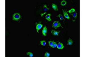 Immunofluorescent analysis of MCF-7 cells using ABIN7170036 at dilution of 1:100 and Alexa Fluor 488-congugated AffiniPure Goat Anti-Rabbit IgG(H+L) (ATP1A1 抗体  (AA 225-407))