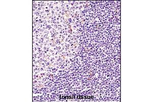 BTK Antibody (N-term) (ABIN657469 and ABIN2846497) immunohistochemistry analysis in formalin fixed and paraffin embedded human tonsil tissue followed by peroxidase conjugation of the secondary antibody and DAB staining. (BTK 抗体  (N-Term))
