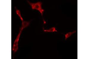 ABIN6274500 staining HeLa cells by IF/ICC. (ZNF436 抗体  (C-Term))