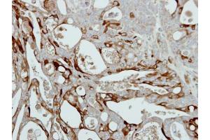 IHC-P Image Immunohistochemical analysis of paraffin-embedded NCIN87 xenograft, using Collagen III alpha1, antibody at 1:500 dilution. (COL3A1 抗体  (C-Term))