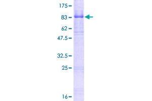 Image no. 1 for Neurotrophic Tyrosine Kinase, Receptor, Type 2 (NTRK2) (AA 1-477) protein (GST tag) (ABIN1313117)