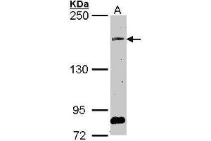 WB Image Sample (30 ug of whole cell lysate) A: A549 5% SDS PAGE antibody diluted at 1:1000 (SOS2 抗体  (Center))