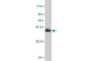 Western Blot detection against Immunogen (42. (MTAP 抗体  (AA 1-154))