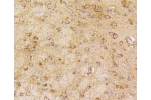 Immunohistochemistry of paraffin-embedded mouse brain using ARRB1 antibody (ABIN4903044) at dilution of 1:100 (40x lens). (beta Arrestin 1 抗体)