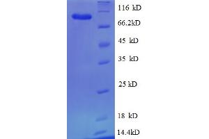 Heat Shock Protein 90kDa beta (Grp94), Member 1 (HSP90B1) (AA 27-799), (partial) protein (His tag)