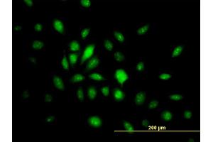 Immunofluorescence of monoclonal antibody to HMG20B on HeLa cell. (HMG20B 抗体  (AA 1-109))