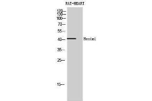 Western Blotting (WB) image for anti-Hexamethylene Bis-Acetamide Inducible 1 (HEXIM1) (Internal Region) antibody (ABIN3184999) (HEXIM1 抗体  (Internal Region))