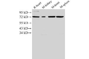 Western Blotting (WB) image for anti-Annexin A6 (ANXA6) antibody (ABIN7234042) (ANXA6 抗体)