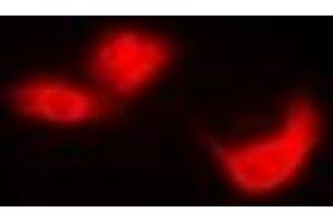 Immunofluorescent analysis of EIF6 staining in Hela cells. (EIF6 抗体)