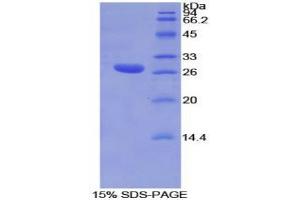 SDS-PAGE analysis of Mouse TOR1AIP2 Protein. (TOR1AIP2 蛋白)