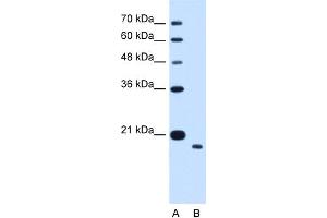 WB Suggested Anti-TMEM91 Antibody Titration:  1. (TMEM91 抗体  (N-Term))