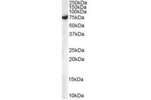 Image no. 1 for anti-Syntaxin Binding Protein 1 (STXBP1) (C-Term) antibody (ABIN374370) (STXBP1 抗体  (C-Term))
