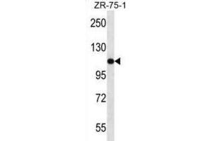 Western Blotting (WB) image for anti-USO1 Homolog, Vesicle Docking Protein (USO1) antibody (ABIN2997687) (USO1 抗体)