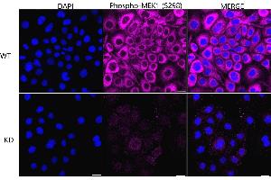 Immunocytochemical staining of HeLa cells using Phospho-MEK1 (S298) antibody (ABIN7799462), 1:1,000), Top panel: wild-type (WT), Bottom panal: Phospho-MEK1 (S298) shRNA knockdown (KD). (Recombinant MEK1 抗体  (pSer298))