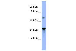WB Suggested Anti-NIT1 Antibody Titration: 0. (Nitrilase 1 抗体  (N-Term))