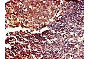 Immunohistochemistry of paraffin-embedded human tonsil tissue using ABIN7150681 at dilution of 1:100 (PDE11A 抗体  (AA 42-190))