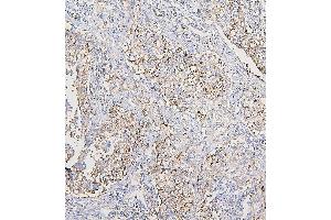 IHC analysis of COPE using anti-COPE antibody (ABIN7602509).