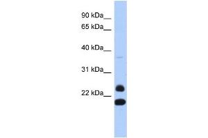 WB Suggested Anti-NEUROG2 Antibody Titration:  0. (Neurogenin 2 抗体  (N-Term))