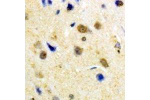 Immunohistochemical analysis of S100-A1 staining in human brain formalin fixed paraffin embedded tissue section. (S100A1 抗体)