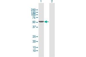 Western Blot analysis of UGT2B15 expression in transfected 293T cell line by UGT2B15 MaxPab polyclonal antibody. (UGT2B15 抗体  (AA 1-530))