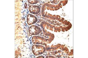 IHC-P Image Immunohistochemical analysis of paraffin-embedded mouse small intestine, using JAM-B, antibody at 1:200 dilution. (JAM2 抗体)
