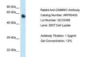 Western Blotting (WB) image for anti-Calcium/calmodulin-Dependent Protein Kinase Kinase 1, alpha (CAMKK1) (C-Term) antibody (ABIN2788438) (CAMKK1 抗体  (C-Term))