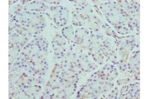 Immunohistochemistry of paraffin-embedded human pancreatic tissue using ABIN7145930 at dilution of 1:100 (CCR4 抗体  (AA 309-360))