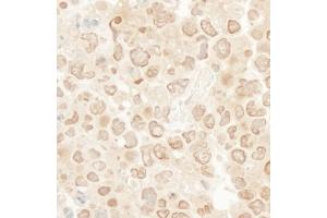 Immunohistochemistry (IHC) image for anti-Kinesin Family Member 2C (KIF2C) (AA 50-100) antibody (ABIN7454690)