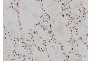 ABIN6259039 and ABIN6273460 at 1/100 staining Human lung tissue by IHC-P.
