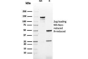 SDS-PAGE Analysis Purified HPV-16 Mouse Recombinant Monoclonal Antibody (rHPV16L1/1058). (Recombinant HPV16 抗体)