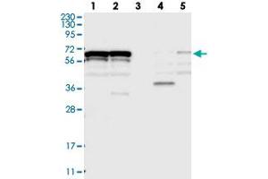 Western blot analysis of Lane 1: RT-4, Lane 2: U-251 MG, Lane 3: Human Plasma, Lane 4: Liver, Lane 5: Tonsil with ZNF655 polyclonal antibody  at 1:250-1:500 dilution. (ZNF655 抗体)