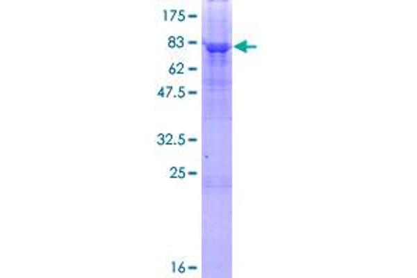 PNPLA3 Protein (AA 1-481) (GST tag)