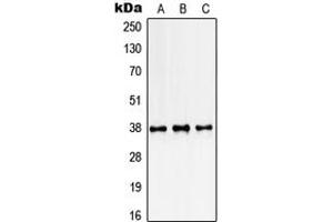 Western blot analysis of SSBP2 expression in K562 (A), NIH3T3 (B), rat kidney (C) whole cell lysates. (SSBP2 抗体  (N-Term))