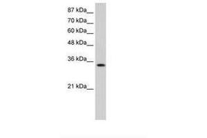 Image no. 2 for anti-Muscleblind-like Protein 1 (MBNL1) (AA 211-260) antibody (ABIN6736245) (MBNL1 抗体  (AA 211-260))