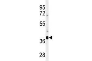 Western blot analysis of SIRT3 antibody and mouse brain tissue lysate (SIRT3 抗体  (AA 304-334))