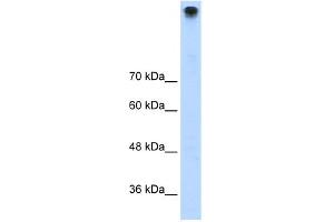 WB Suggested Anti-TRPM3 Antibody Titration:  1. (TRPM3 抗体  (N-Term))