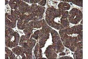Image no. 1 for anti-Receptor Accessory Protein 5 (REEP5) antibody (ABIN1500659) (REEP5 抗体)