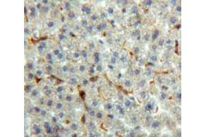 Used in DAB staining on fromalin fixed paraffin-embedded Liver tissue (Prothrombin 抗体  (AA 44-198))