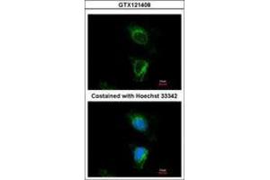 Image no. 3 for anti-Dihydrouridine Synthase 2-Like (DUS2L) (AA 1-199) antibody (ABIN1497929) (DUSL2 抗体  (AA 1-199))