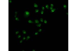 Immunofluorescence staining of Hela cells with ABIN7144542 at 1:110,counter-stained with DAPI. (ALOX5 抗体  (AA 2-149))