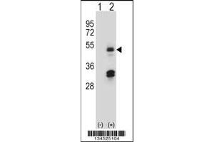 Western blot analysis of HAT1 using rabbit polyclonal HAT1 Antibody using 293 cell lysates (2 ug/lane) either nontransfected (Lane 1) or transiently transfected (Lane 2) with the HAT1 gene. (HAT1 抗体  (N-Term))
