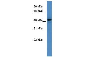 WB Suggested Anti-RNF128 Antibody Titration: 0. (RNF128 抗体  (C-Term))