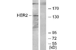 Immunohistochemistry analysis of paraffin-embedded human breast carcinoma tissue using HER2 antibody. (ErbB2/Her2 抗体)